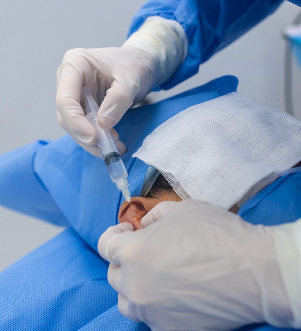 otoplastia